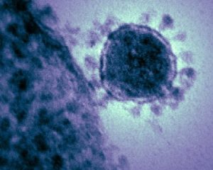 768px-Middle_East_respiratory_syndrome-related_coronavirus